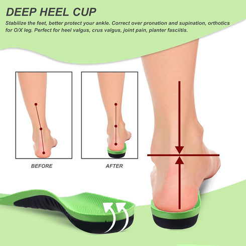 Kids Orthotic Arch Support Insoles – Plantar Fasciitis Cushioning Shoe Inserts for Flat Feet, Feet Heel Pain Relief