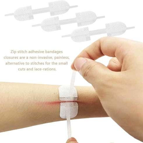 Emergency Wound Closures Adhesive Bandages, Zip Stitch Stickers for Camping, Survival & Household Gear, 3 Pcs (70 *