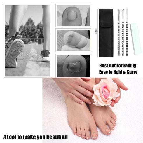 Stainless Steel Ingrown Toenail Pedicure Knife Set, Professional Foot Skin Scraper Kit