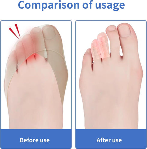Yomanosk 30PCS Silicone Anti-Friction Toe Protector,Soft Clear Little Gel Toe Protectors Breathable Toe Covers for Men