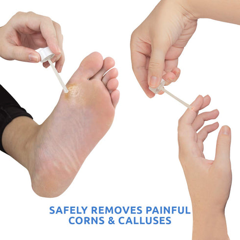 Maximum Strength Liquid Corn & Callus Remover for Feet & Hands, 0.33 Oz, 4 Piece Set