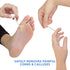 Maximum Strength Liquid Corn & Callus Remover for Feet & Hands, 0.33 Oz, 4 Piece Set