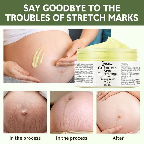 Stretch Marks and Scars Removal Cream for Pregnancy, Gentle Skincare for Abdominal Firming