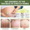 Stretch Marks and Scars Removal Cream for Pregnancy, Gentle Skincare for Abdominal Firming