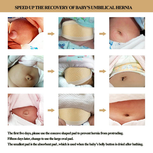 Umbilical Hernia Belt for Baby/Infant, Adjustable Belly Button Band Wrap Truss for Kids Support, 15-20 inch