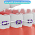 Easy-to-Use Sponge Floss - Cleaning of Implants and Bridges with Stiff Plastic Ends for Oral Hygiene
