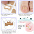 Ingrown Toenail Correction Patch, 50 Pcs Glue-free Stickers for Professional Foot Care
