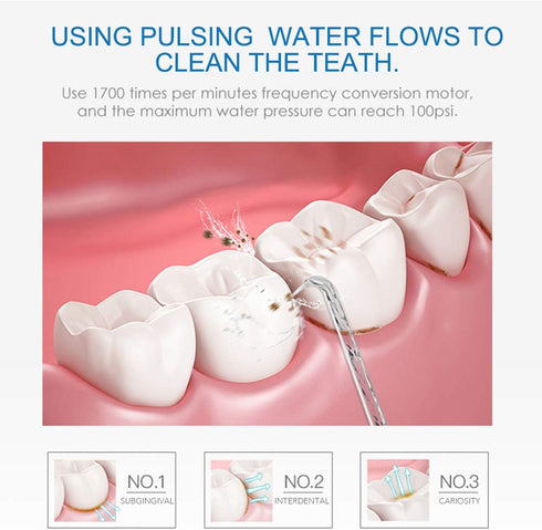 TUREWELL Dental Water Flosser Nozzles, 7PCS Replacement Jet Tips for Family Oral Irrigator Models FC165, FC168 & More
