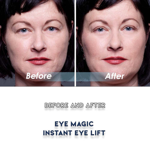 Original Eye Lift Kit, Small/Medium Size with Gel, Lifts Eyelid Droop and Hooded Eyes
