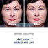 Original Eye Lift Kit, Small/Medium Size with Gel, Lifts Eyelid Droop and Hooded Eyes