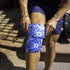 HurtSkurt Revolutionary Stretch-to-Fit Hot and Cold Pack for Pain Relief, Reusable Gel Pack Sleeve