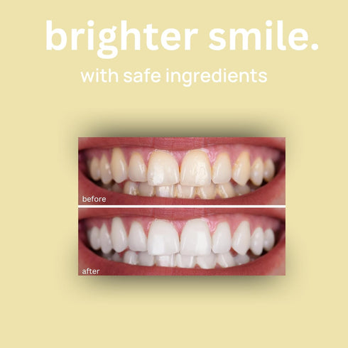 Hydroxyapatite Toothpaste by Optivida Health | Teeth Whitening with Nano Silver, Fluoride Free, Supports Gum Health