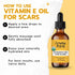 Organic Vitamin E Oil for Scars - All Natural & Vegan Skin Moisturizer 1oz - Light and Unscented for Scars, Wrinkles,