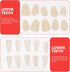 EXCEART Teeth Veneer 100 Pieces Artificial Resin Tooth Fillings, Temporary Tooth Replacements