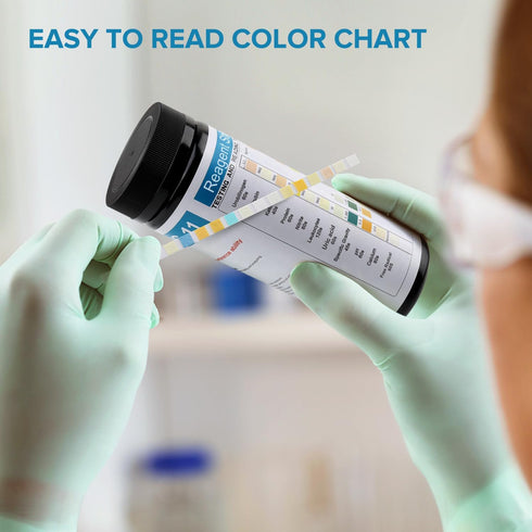 RPOMU 11 100 Count Urine Test Strips Parameters
