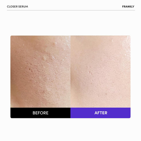 Frankly Closer Serum, 9 Peptides & Vegan Collagen, Pore Minimizer & Anti-Aging Hydrator, 2.03 fl. Oz.