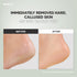 S-Line Emery Foot File, Double-Sided Pedicure Tool for Cracked Heels, Ergonomic Design
