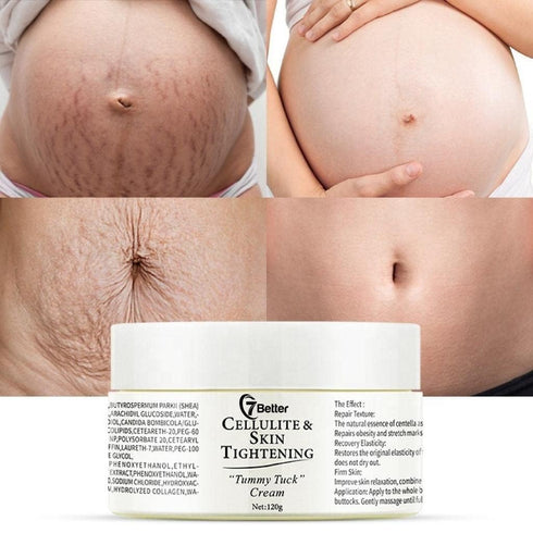 Stretch Marks and Scars Removal Cream for Pregnancy, Gentle Skincare for Abdominal Firming