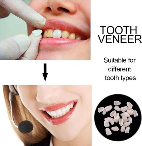 Fake Tooth Repair Kits for Filling Missing Broken Tooth and Gaps, Moldable Fake Teeth and Thermal Beads Replacement Kits
