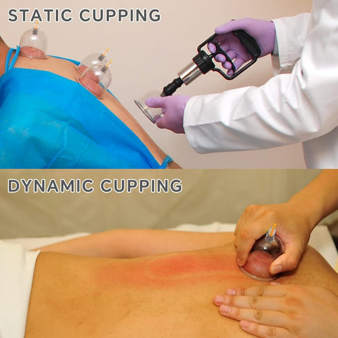 Set 12 Cupping Kit for Massage Therapy with Pump Massage Cups for Cellulite Reduction Muscle Back Pain Relief Physical