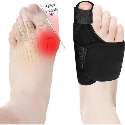 Bunion Corrector for Women and Men - Adjustable Orthopedic Splint, 2 Pcs Bunion Pads for Hallux Valgus Pain Relief