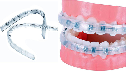 Comfort Cover for Braces, Lip Protector Mouth Guard, Teeth Shield Bumper for Brackets and Aligners