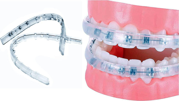 Comfort Cover for Braces, Lip Protector Mouth Guard, Teeth Shield Bumper for Brackets and Aligners