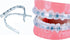 Comfort Cover for Braces, Lip Protector Mouth Guard, Teeth Shield Bumper for Brackets and Aligners