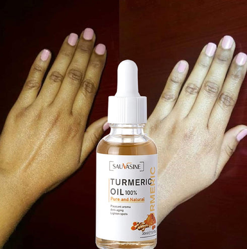 Lanthome Turmeric Oil for Dark Spots on Face, Moisturizing, Rejuvenating, Soothing, Anti-Aging Skin Repair