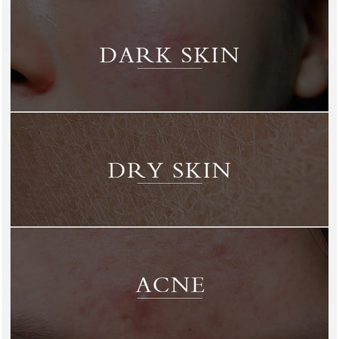 NP 2PCS Turmeric Face Cream, Anti-Aging Moisturizer with Organic Ingredients for Dull Dry Skin