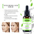 Neutriherbs Hyaluronic Acid Serum, 30ml, Lightweight Daily Facial Serum for Oily & Acne-Prone Skin