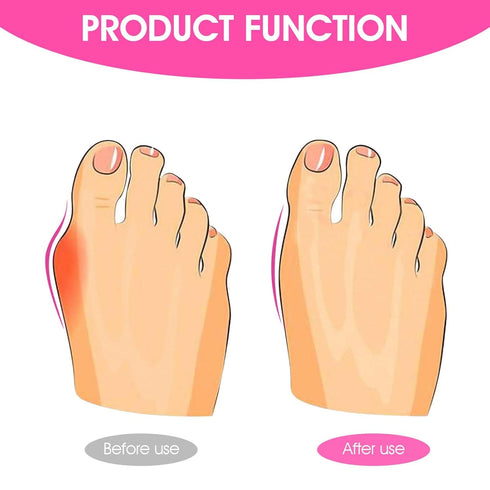 Ptwola Hallux Valgus Protector Sleeves Kit Bunion Corrector Sleeve Gel Pad Bunion Pain Relief Orthopedic Socks Big Toe
