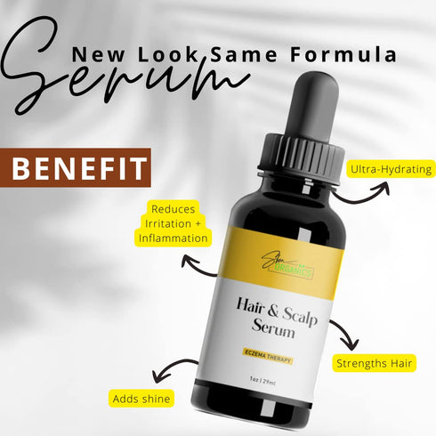 Shea Organics Soothing Scalp Oil – 1 OZ | Gentle Moisturizer for Baby Eczema & Sensitive Skin, Oat Oil & Vitamin E