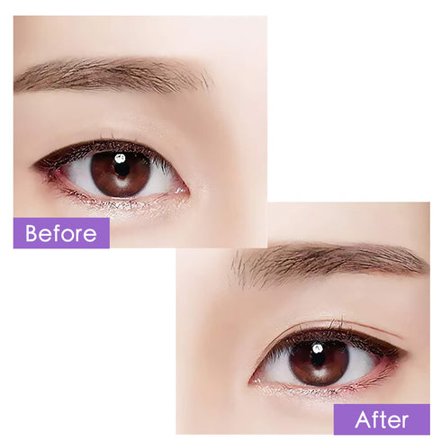 Ultra Invisible Double Eyelid Tape Stickers - 200Pcs/100Pairs Both Side Sticky Instant Eye Lid Lift Strips for Hooded