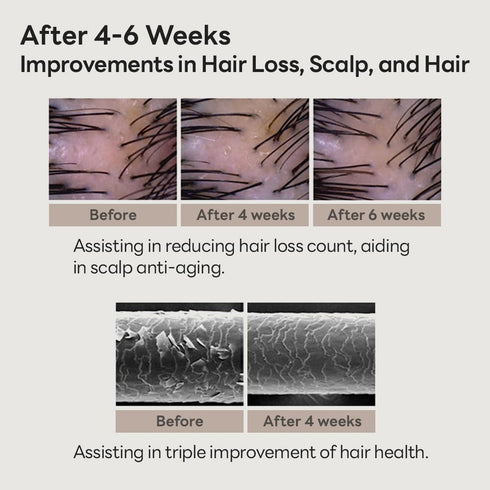 Scalp Intensive Shampoo, Anti-Hair Loss Shampoo for Men and Women, Korean Hair Regrowth with Biotin