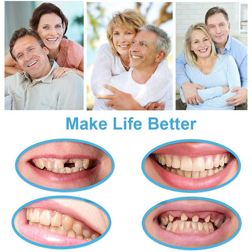 Tooth Repair Kit for Fixing Missing, Chipped, and Broken Tooth Gap with Thermal Beads and Fake Teeth Brace Mold