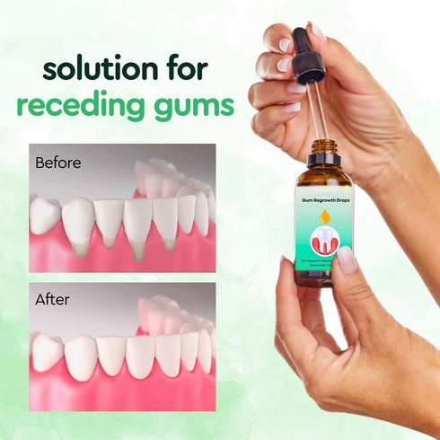 3PCS DentiZen Gum Regrowth Drops, Natural Gum Liquid Drops for Gum Relief and Mouthwash