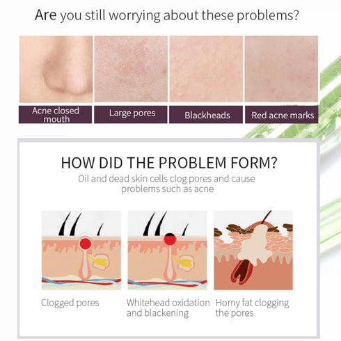 Peeling Solution AHA 30% + BHA 2% - Exfoliating Facial Serum Chemical Peel for Face, Reduces Blemishes and Fine Lines