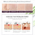 Peeling Solution AHA 30% + BHA 2% - Exfoliating Facial Serum Chemical Peel for Face, Reduces Blemishes and Fine Lines