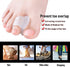 Welnove 10 Pack Toe Separators Gel Toe Spacers for Bunions, Overlapping Toes, and Pain Relief Pads - Clear