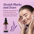 Natural Lavender Body Oil - Skincare with Vitamin E and Rosehip Oil for Stretch Marks, Scars, Pregnancy Must-Haves. Cream and Oils for Women, Dry Skin | 4oz