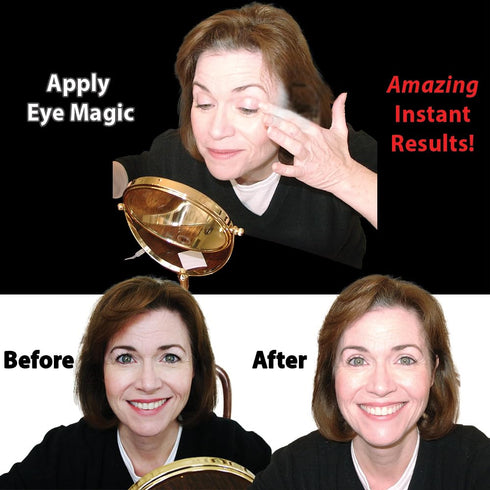 Original Eye Lift Kit, Small/Medium Size with Gel, Lifts Eyelid Droop and Hooded Eyes