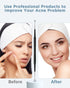TAYTHI Blackhead Remover Tool Kit, Pimple Popper Extractor Tool for Face, Stainless Steel for Comedone, Zit, Acne,