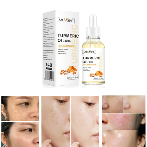 Lanthome Turmeric Oil for Dark Spots on Face, Moisturizing, Rejuvenating, Soothing, Anti-Aging Skin Repair