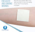 Dynarex DynaGinate Calcium Alginate Wound Dressing, Sterile, Non-Stick, 2"x 2", Box of 10, Absorbent Gel Patches