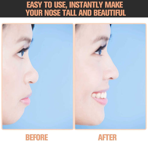 Maitys Nose Up Lifting Shaper Clip, 2 Sets Silicone Beauty Tools for Invisible Face Slimming