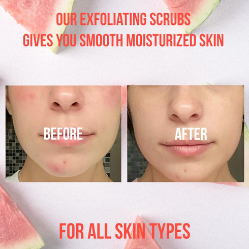Organic Pink Watermelon Body Scrub, Gentle Exfoliator for Smooth Skin, Hydrating & Moisturizing Scrub