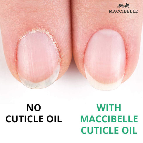 Maccibelle Cuticle Oil, 0.5 oz Heals Dry Cracked Cuticles, Peppermint