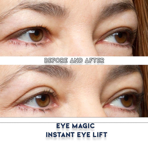 Original Eye Lift Kit, Small/Medium Size with Gel, Lifts Eyelid Droop and Hooded Eyes