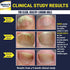 Nail Clarifying Gel, Clinically Proven for Discolored and Damaged Toenails, Effective Treatment